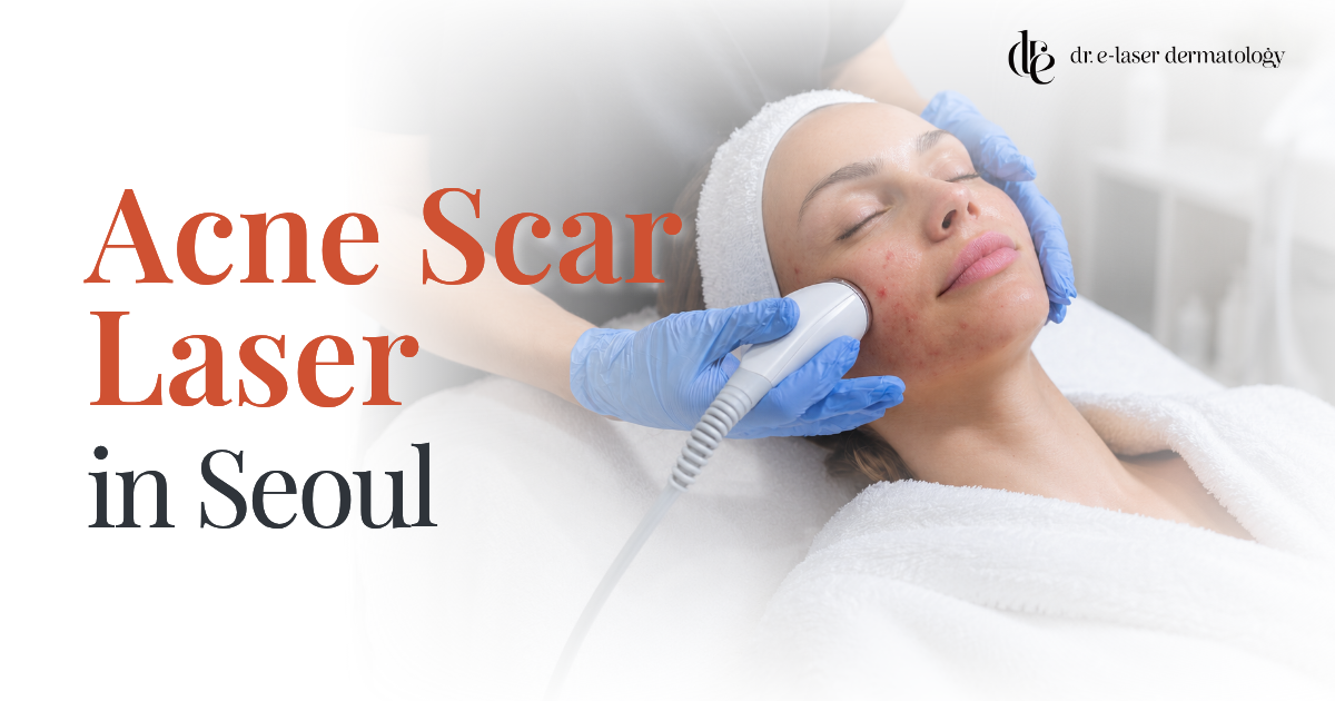 Acne scar laser treatment in Seoul doctor-led guide for international patients