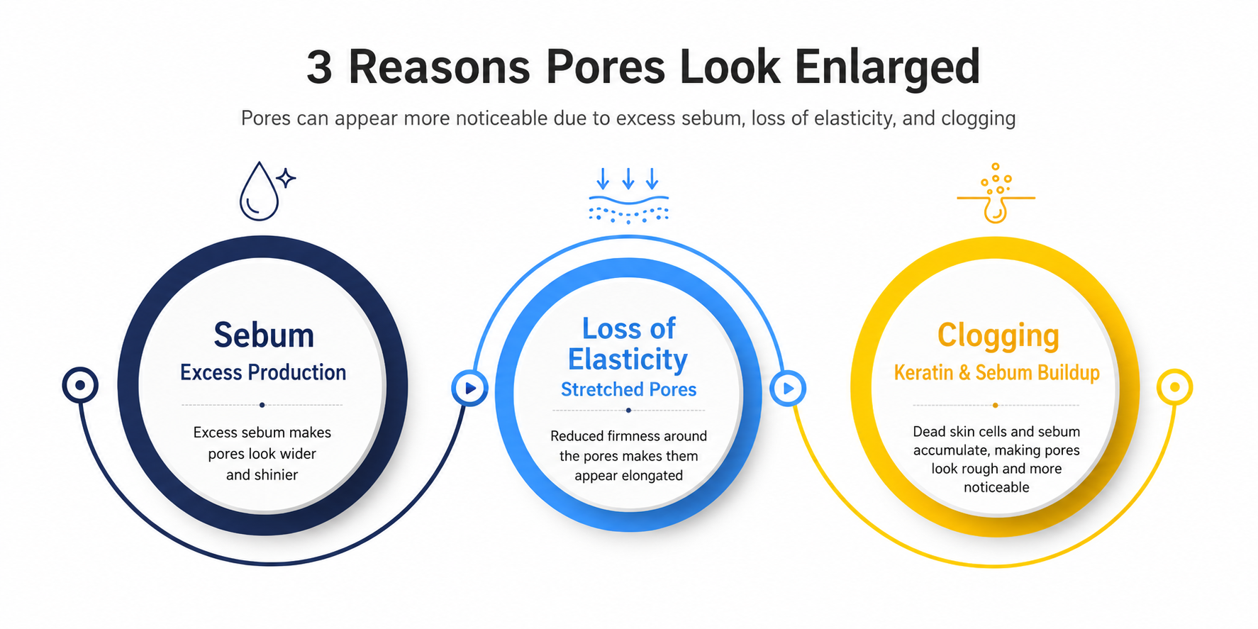 Diagram of why pores look enlarged: oil, loss of firmness around the pore, and congestion
