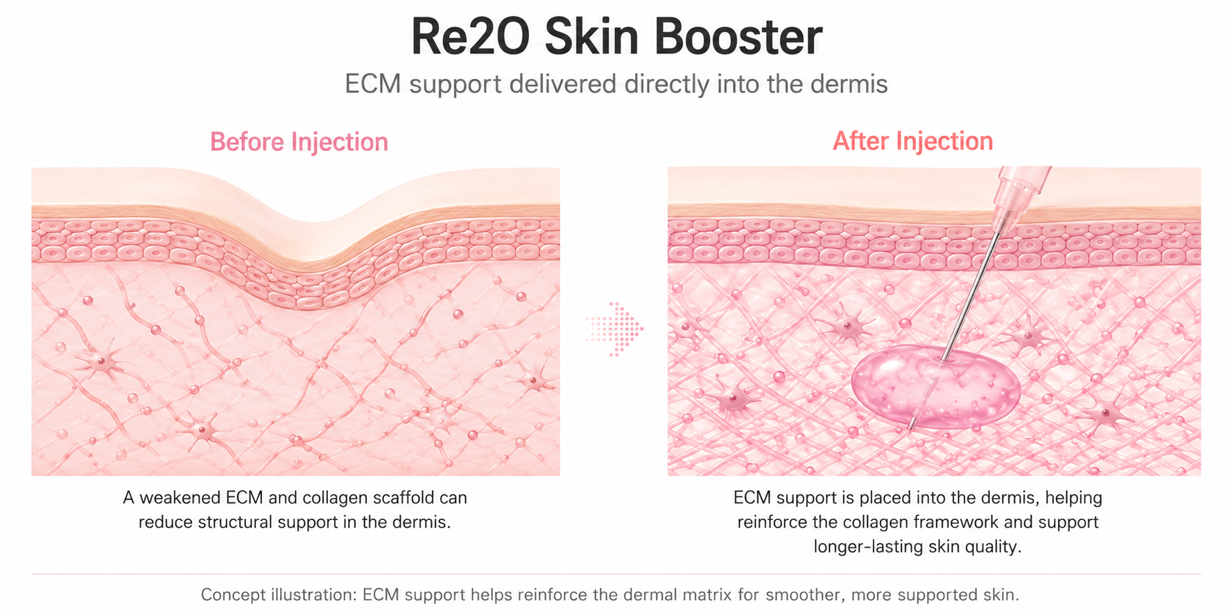 Diagram showing how Re2O replenishes the extracellular matrix scaffold in the skin