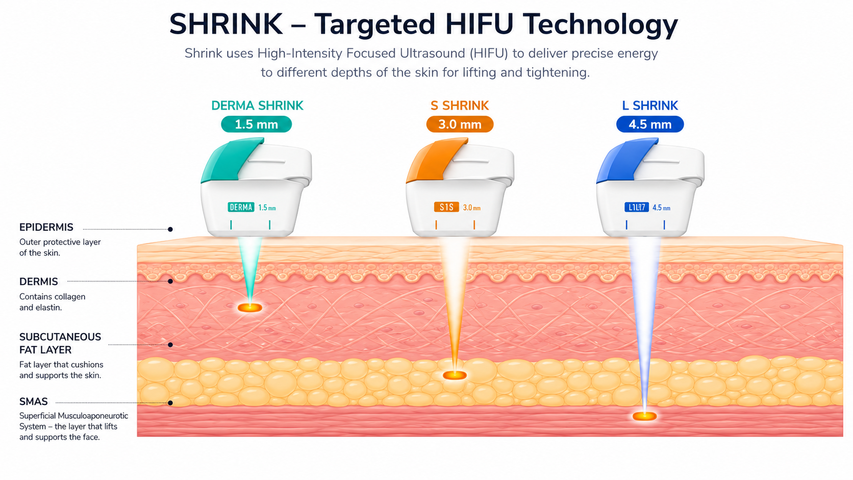 Diagram showing how Shurink Universe focused ultrasound reaches three skin depths for collagen lifting