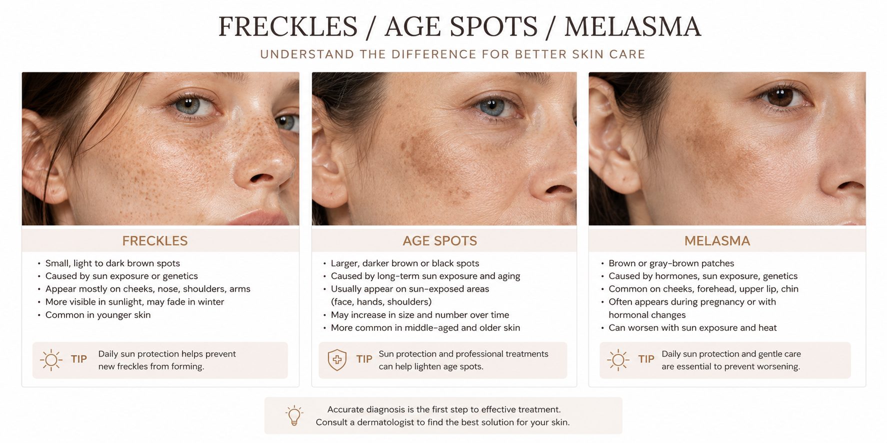 Comparison of freckles, age spots and melasma with a close-up example of each pigment type