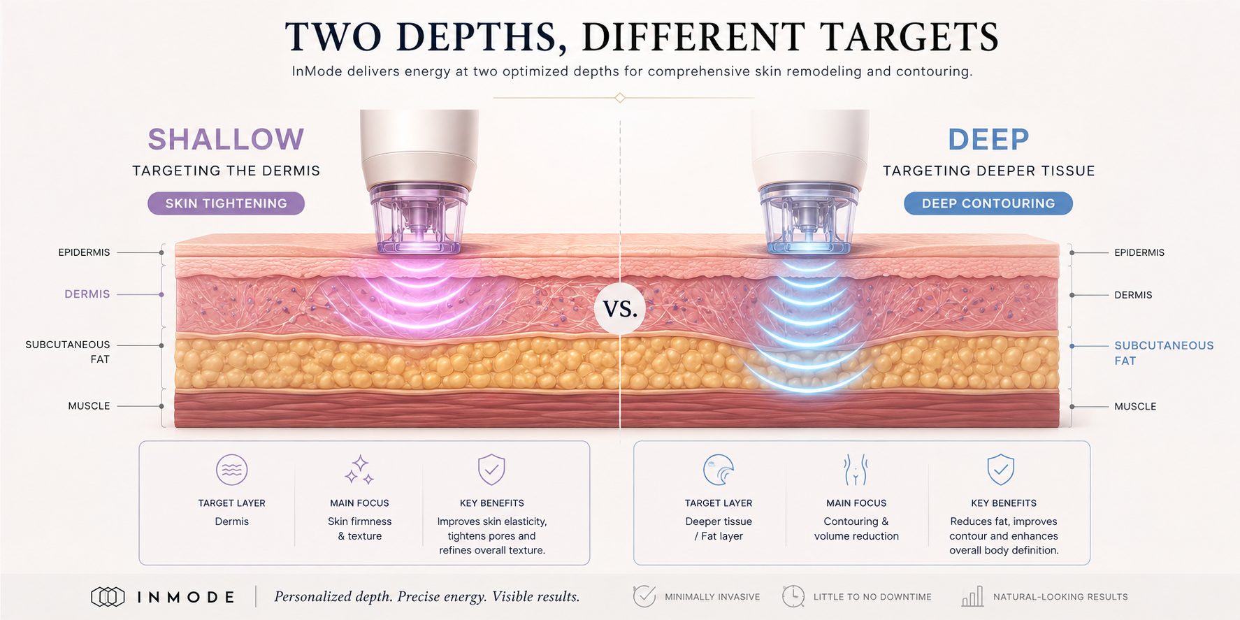 Cross-section diagram of InMode energy delivered at two depths, the dermis and the fat layer