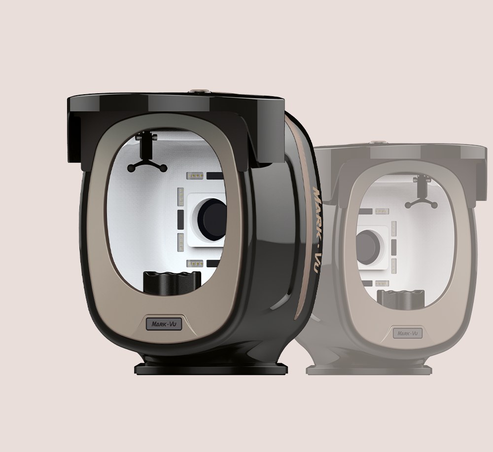 Pigmentation analysis device used for melasma consultation in Seoul