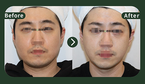 [Lifting] 30s Before and after